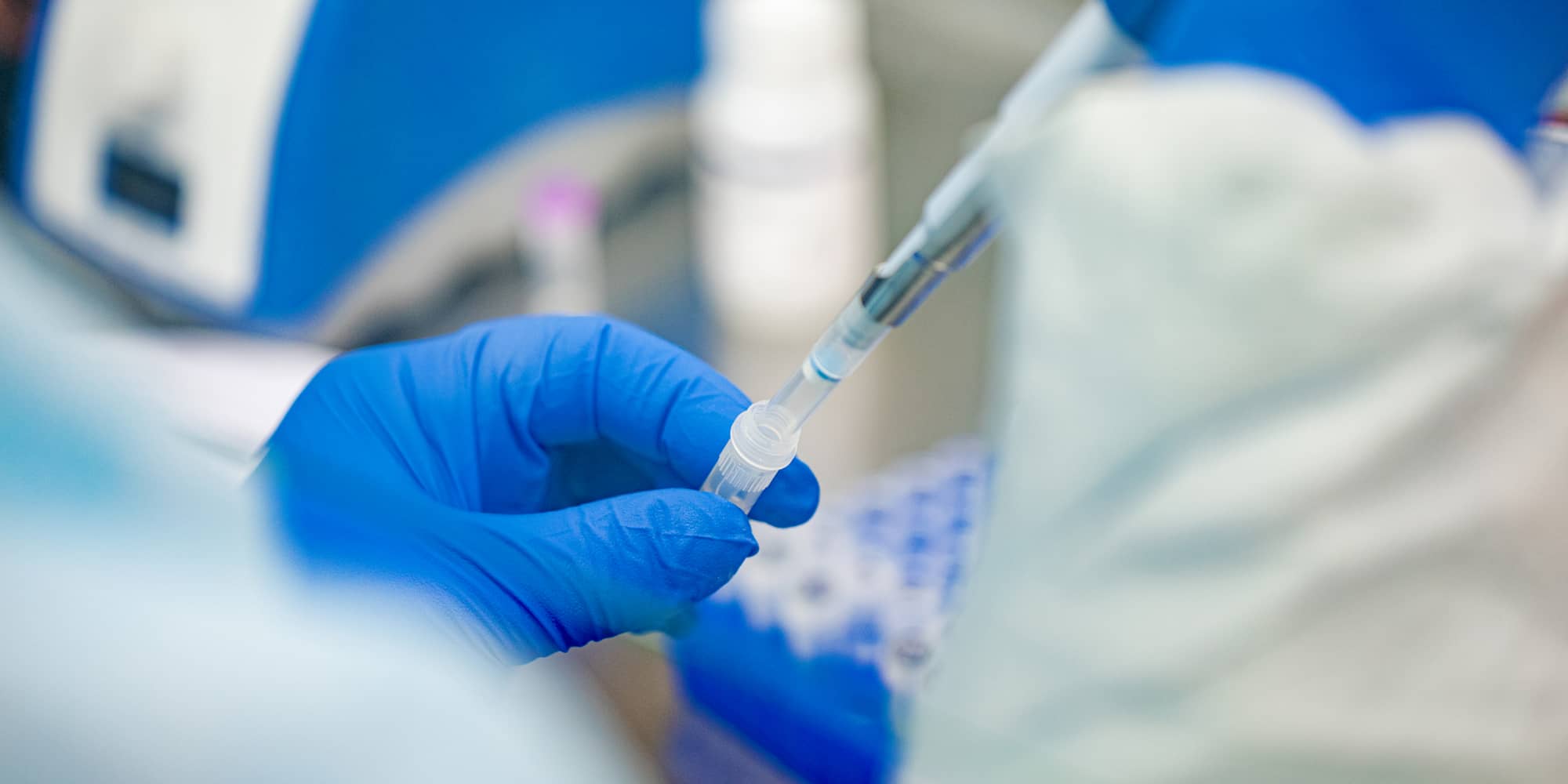 Vancouver Island Has 22 COVID-19 Cases, But We Don’t Know Where They Are